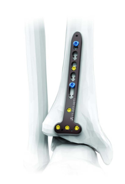 PLACAS TIBIA DISTAL - Image 3