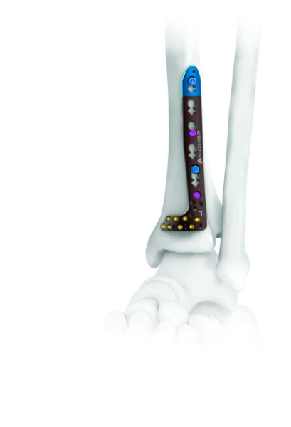 PLACAS TIBIA DISTAL - Image 4